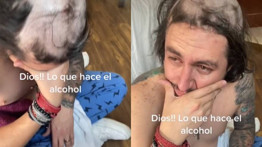 Hombre llegó borracho a su casa y sus hijos lo raparon cuando estaba dormido