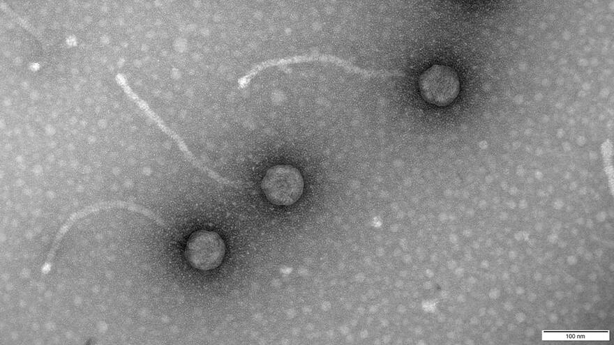 Fagos, los virus 'come' bacterias para combatir la resistencia a los antibióticos