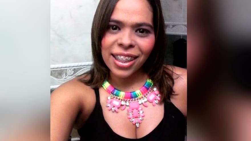 Economista, la víctima fatal de choque entre busetas en el norte