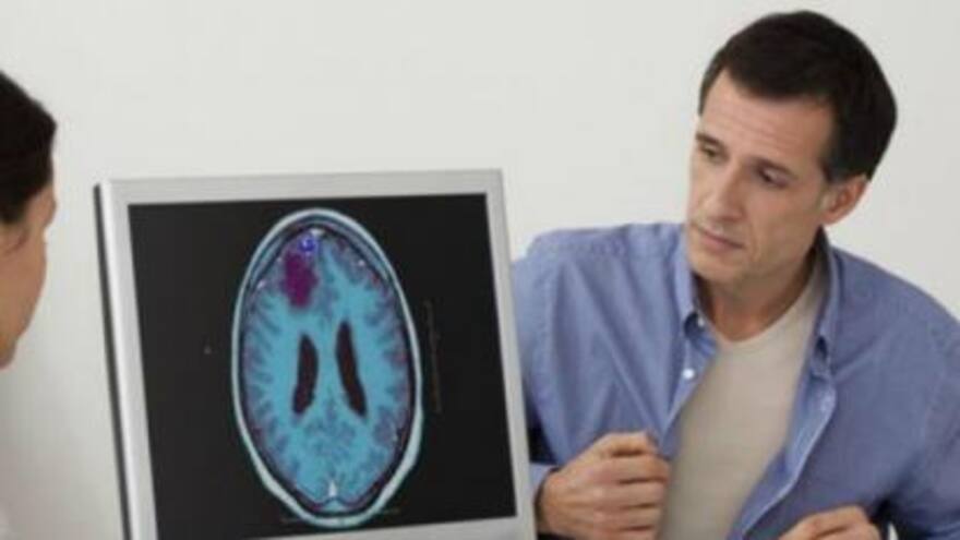 Descubren 29 genes que aumentan el riesgo de desarrollar epilepsia