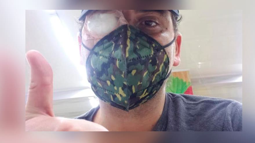 Tres ataques con ácido en los últimos días en Bogotá