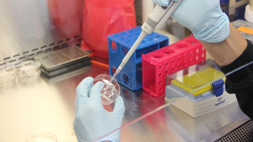 Se confirma sexto caso exitoso de remisión del VIH tras trasplante de médula