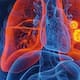 Identifican una proteína que “alimenta” el cáncer de pulmón