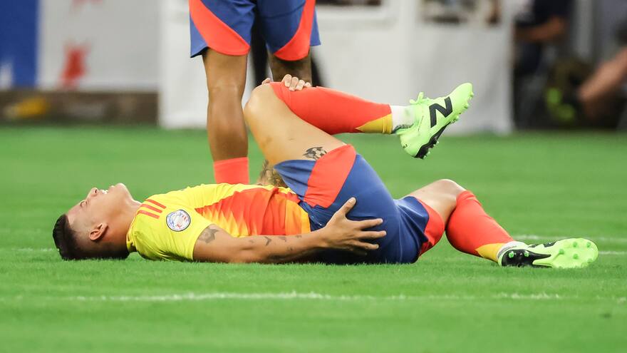El estado de los terrenos de juego, un dolor de cabeza en la Copa América