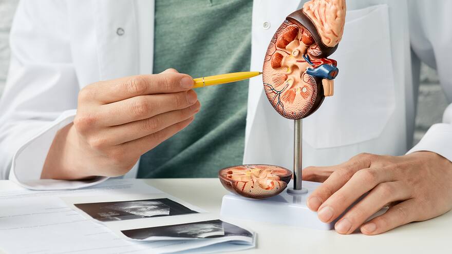 Cáncer renal, enfermedad silenciosa que se previene con buenos hábitos