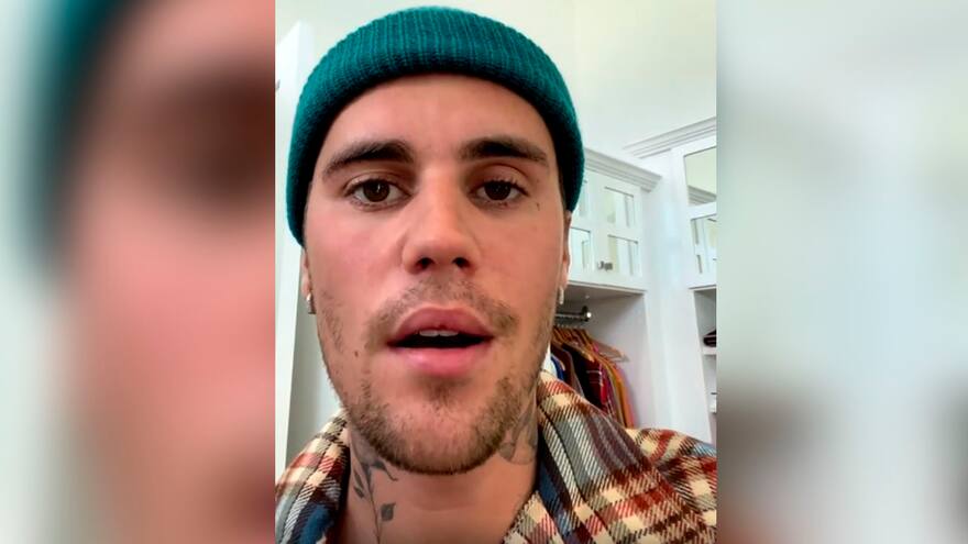 ¿Qué es el síndrome de Ramsay Hunt, la enfermedad que sufre Justin Bieber?