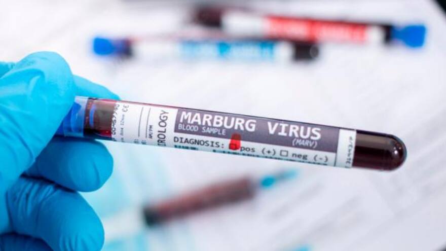 OMS confirmó muerte por virus de marburgo