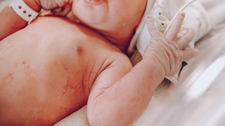 Bebé milagro nace sano tras un embarazo ectópico abdominal oculto detrás de un enorme tumor