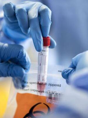 La anhelada “bala de plata”