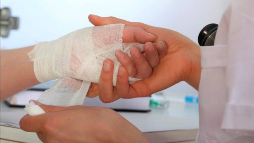 Cifra de quemados por pólvora en Córdoba durante temporada de fin de año