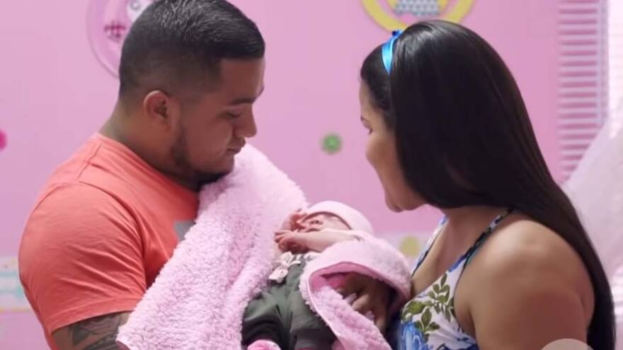 El curioso caso de una bebé que nació con un feto en su vientre