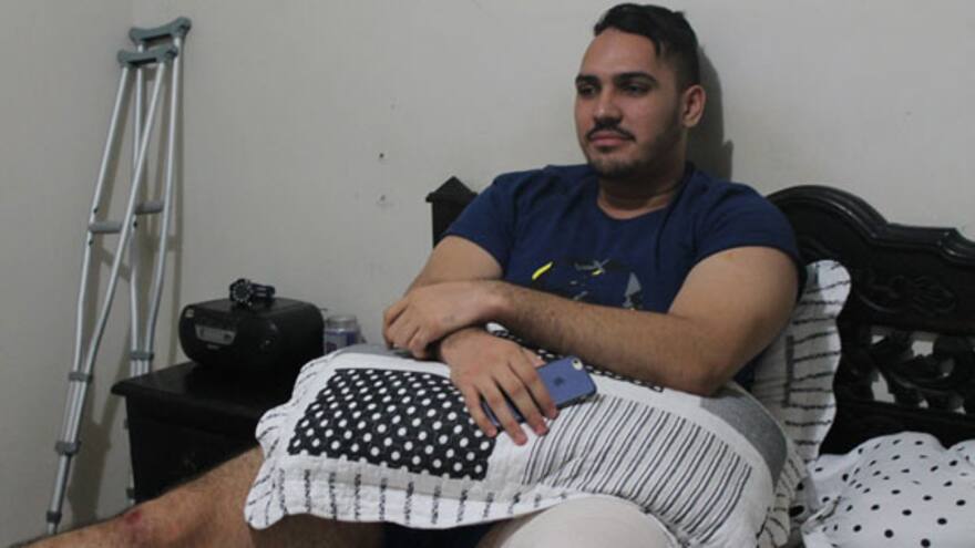 Policía identifica a los dos asaltantes que hirieron al hijo del cantante Beto Zabaleta