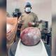 Es el más grande que he extraído: ginecólogo que extirpó tumor de 12 kilos