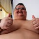 El hombre más obeso del mundo será operado para bajar de peso