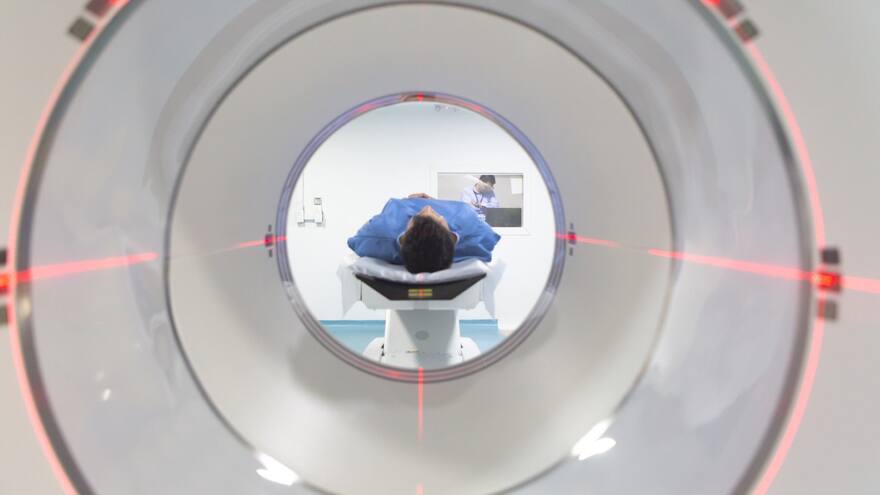 Accidentes cerebrovasculares: cómo prevenirlos y cuáles son señales de alerta