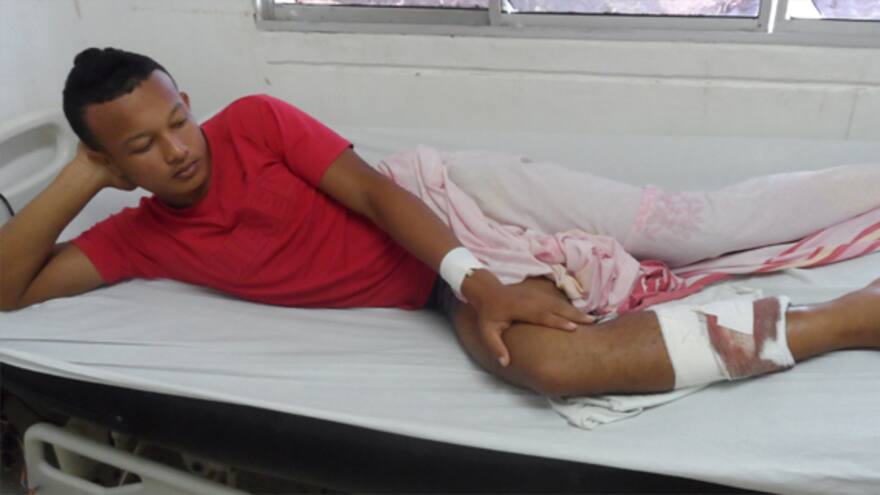 Cuñada lo hirió de un botellazo en la pierna