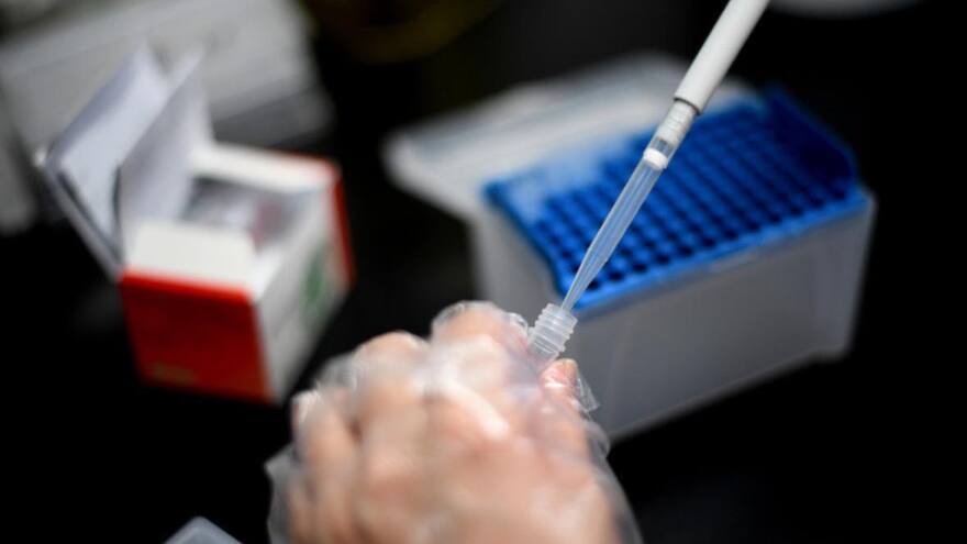 Viruela del mono: detectan segundo caso en Chile