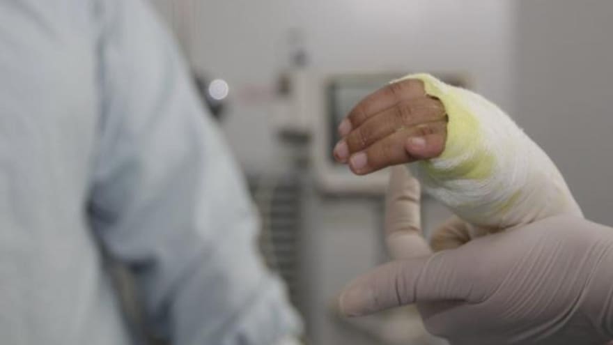 Conmoción en Cauca por madre que habría prendido fuego a su hija de 4 años