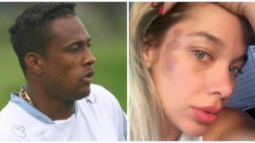 'Yo en ningún momento le pegué ni mordí a mi exesposa': Luis Yánez