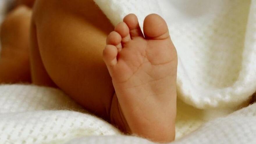 Bebé con dos cabezas, tres manos y dos corazones: Nacen gemelos unidos en India