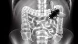 Descubren una mosca viva en el intestino de un hombre en Misuri, EE. UU.