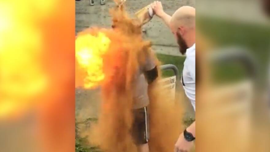 En video | Por broma hombre termina ardiendo en llamas
