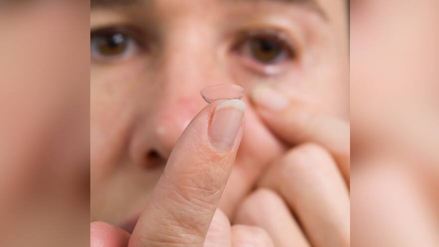 A una mujer le retiraron 23 lentes de contacto: no sabía que debía quitárselos