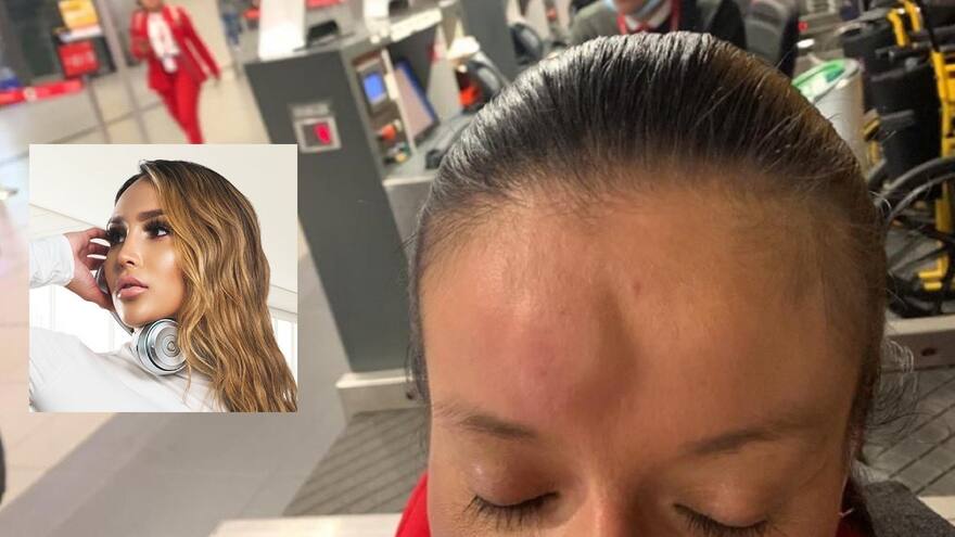 Reconocida Dj caleña le pegó un cabezazo a auxiliar de vuelo