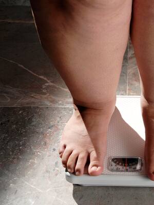 Obesidad | Columna de Remberto Burgos