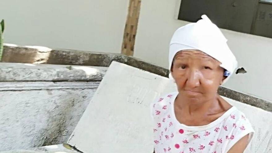 Habitante de la calle con enfermedad mental escapa del hospital de Barranquilla