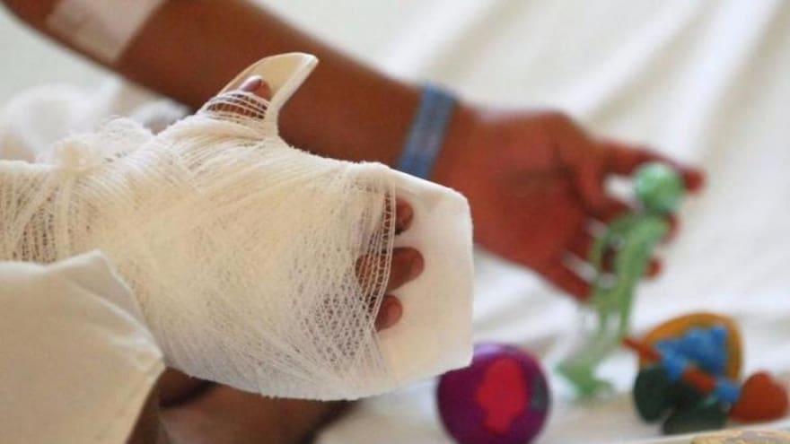 Noche de velitas: 10 personas resultaron quemadas en el Magdalena