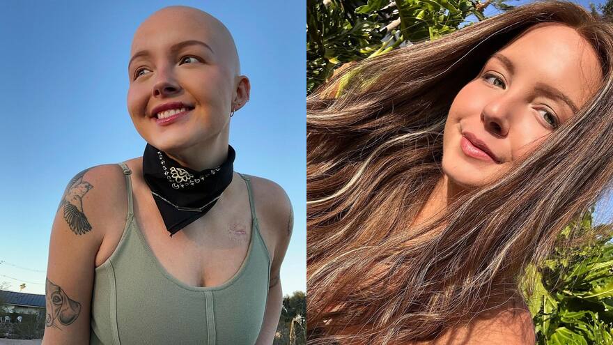 Fallece Maddy Baloy, famosa 'tiktoker' que relató su lucha contra el cáncer