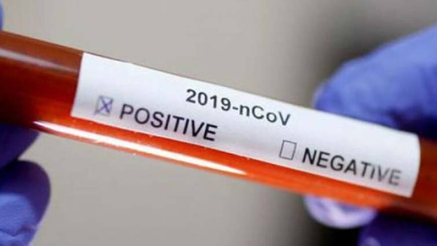 Un joven 19 años es el nuevo caso de COVID-19 en La Guajira