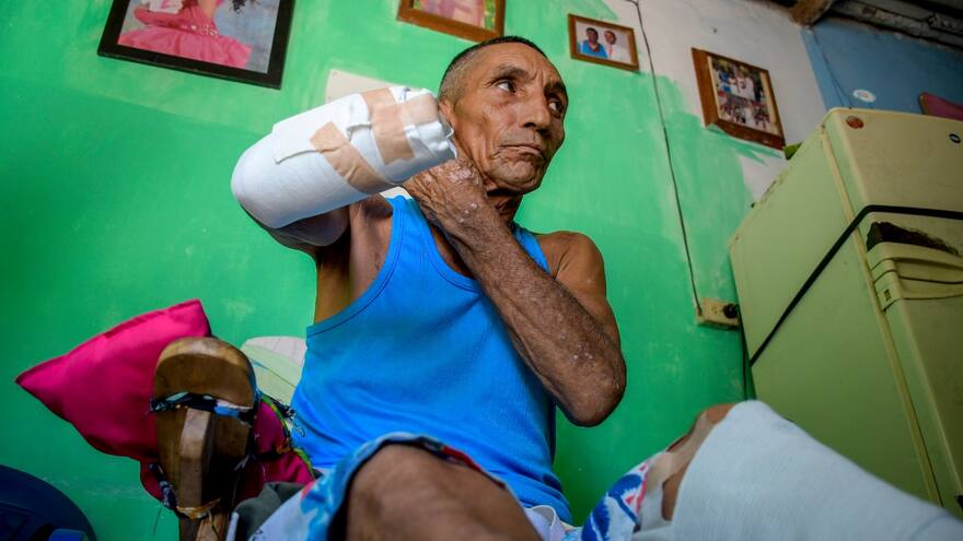 Cercenan la mano a adulto mayor en medio de una riña en Barranquilla