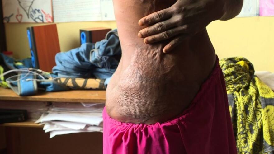 Terror en Papúa Nueva Guinea por caza de ‘brujas’