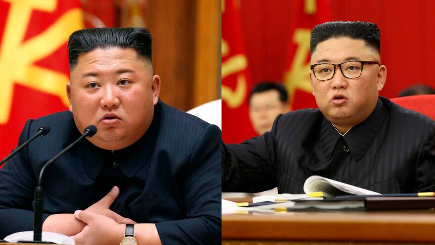 Estado físico de Kim Jong-Un desata nuevas especulaciones sobre su salud