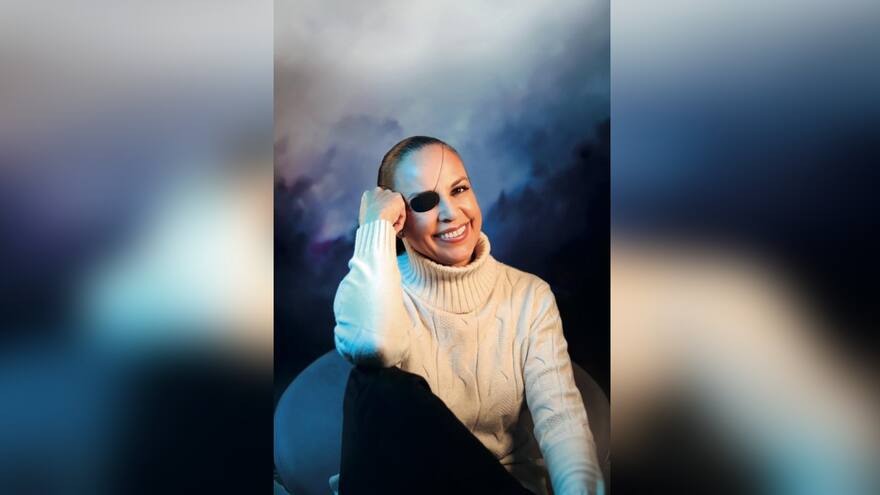 'A raíz del atentado encontré lo que buscaba en mi belleza interior'