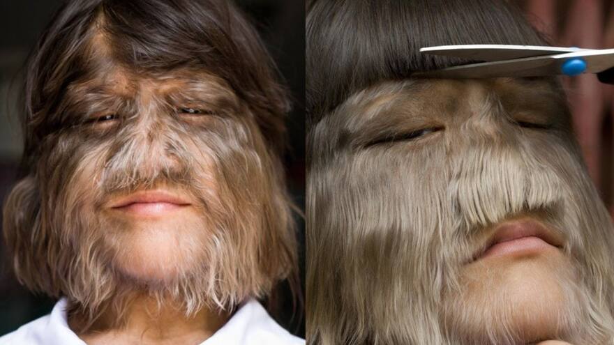 Así luce la mujer más peluda del mundo tras depilarse