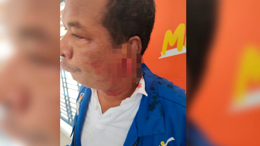 Acto de intolerancia en Transmetro: facilitador fue agredido por un usuario