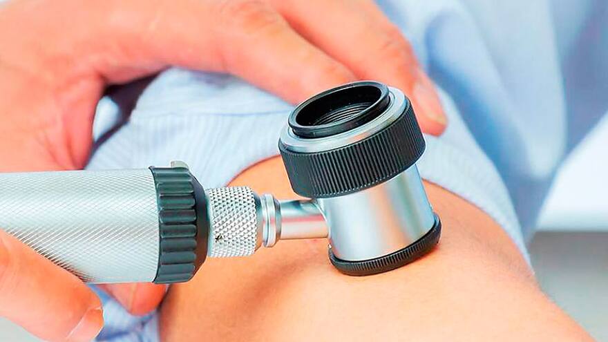 CIDH ordenó medidas cautelares para enfermos