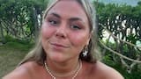Mujer de 24 años murió por extraña enfermedad: los médicos creyeron que se trataba de una simple alergia