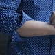¿Las alergias pueden desaparecer con el tiempo? Esto explican los expertos