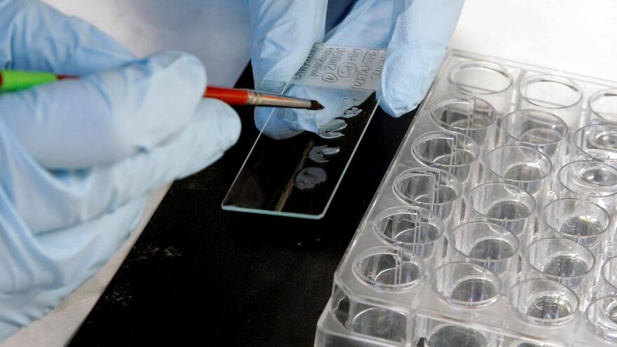 Identifican las células que provocan la recaída en el cáncer de colon