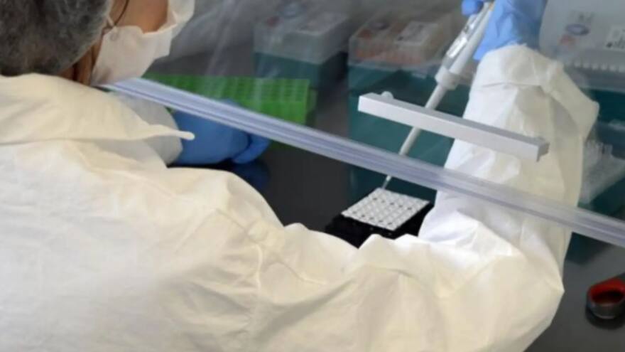 Viruela del mono: confirman el cuarto caso en Argentina