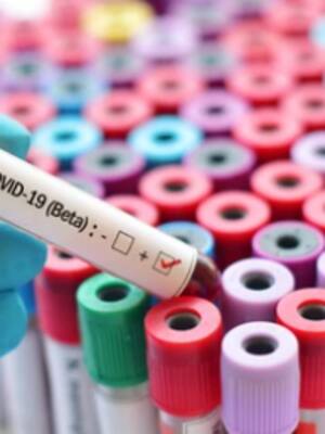 ¿Viene lo peor?| columna de Simón Gaviria