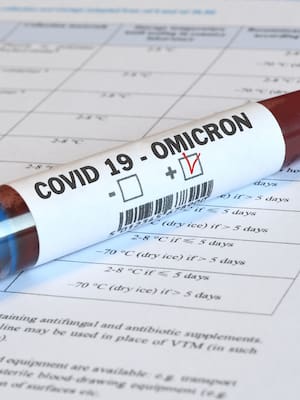 El porqué de Ómicron | Columna de Jesús Ferro Bayona