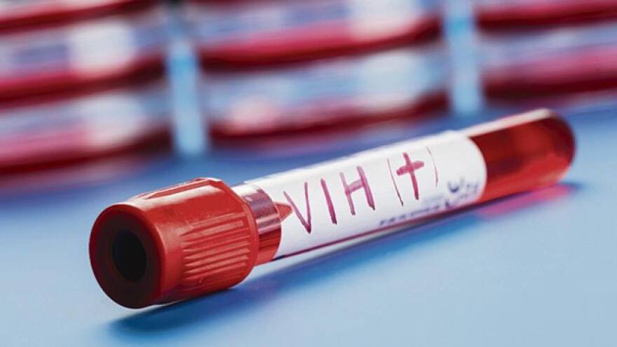 El VIH en diez grandes fechas