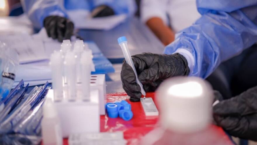 Variante británica ya circula en Cartagena: Dadis