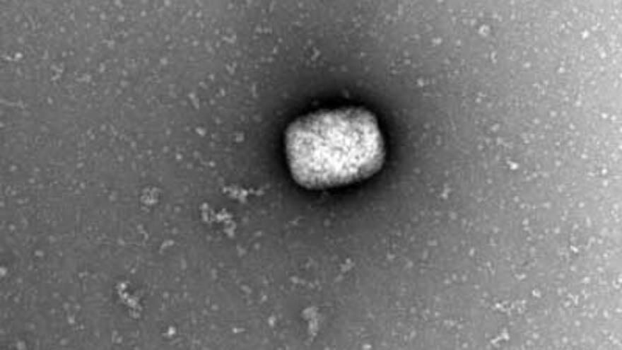 Turista contagiado con viruela del mono escapa de hospital