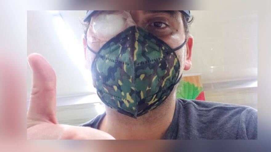 Tres ataques con ácido en los últimos días en Bogotá